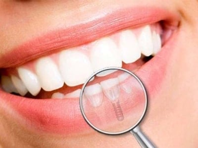 Οδοντίατρος Γλυφάδα | Μαρία Λάλουση Οδοντίατρος Μαρία Λαλούση Γλυφάδα