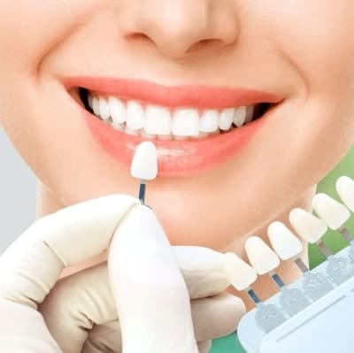 Αισθητική Οδοντιατρική Γλυφάδα Οδοντίατρος Μαρία Λαλούση Γλυφάδα