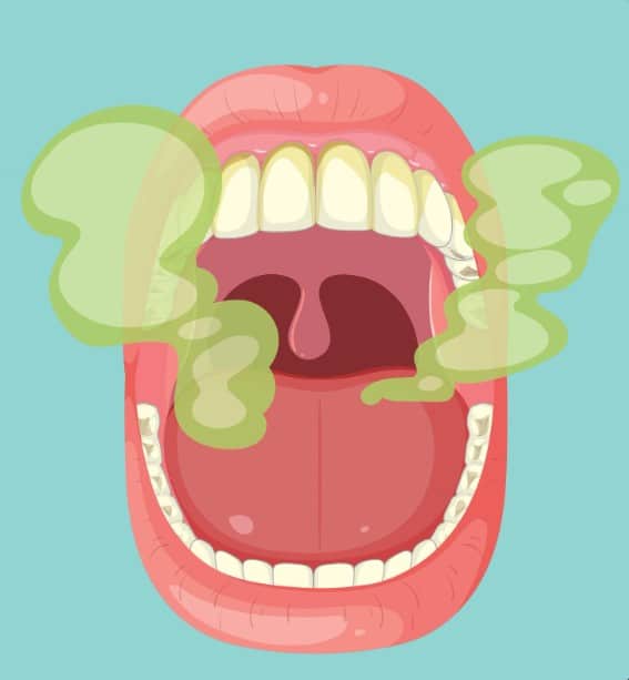 Κακοσμία στόματος: λύσεις που δουλεύουν, αιτίες & πότε θέλει έλεγχο Οδοντίατρος Μαρία Λαλούση Γλυφάδα