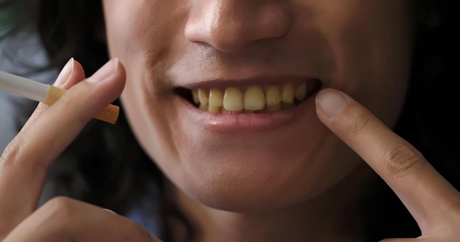 ΚΙΤΡΙΝΑ ΔΟΝΤΙΑ